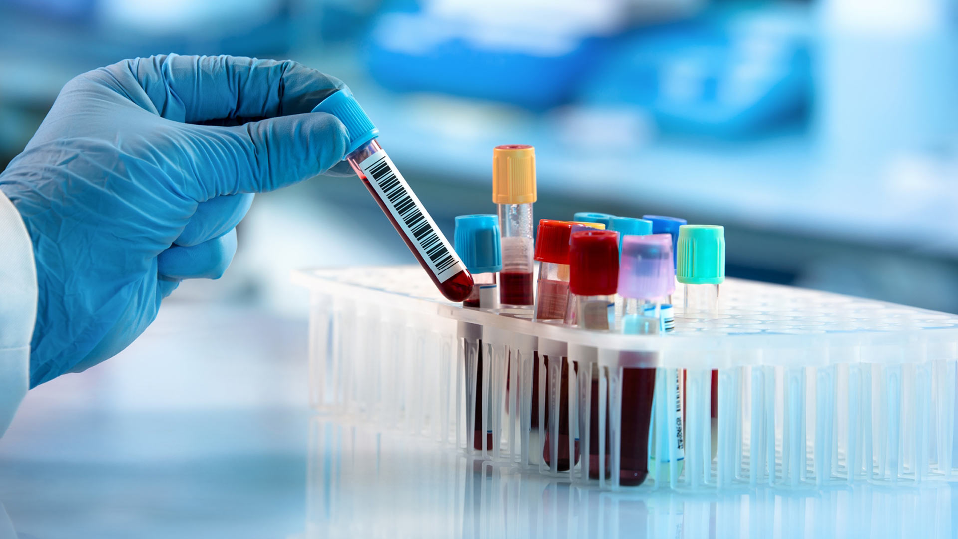 IMMUCARE, India’s first exclusive diagnostic lab for autoimmune diseases, launched in Kochi