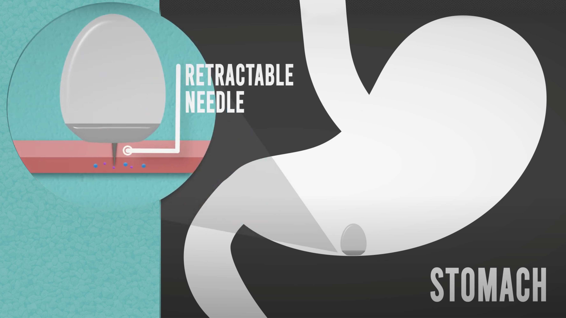 Drug delivery capsules could replace injections for protein drugs