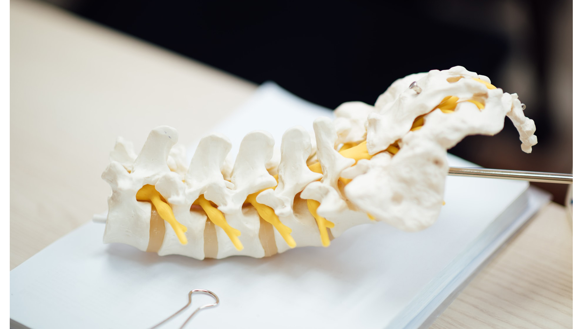NuVasive introduces 3Dprinted porous titanium implant for spine