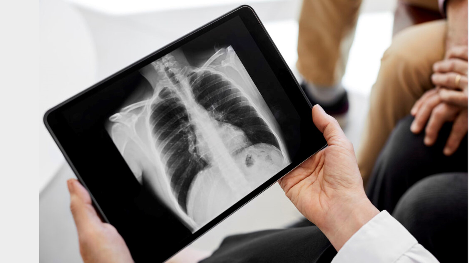 A neurosurgeon’s guide to stroke Healthcare Radius