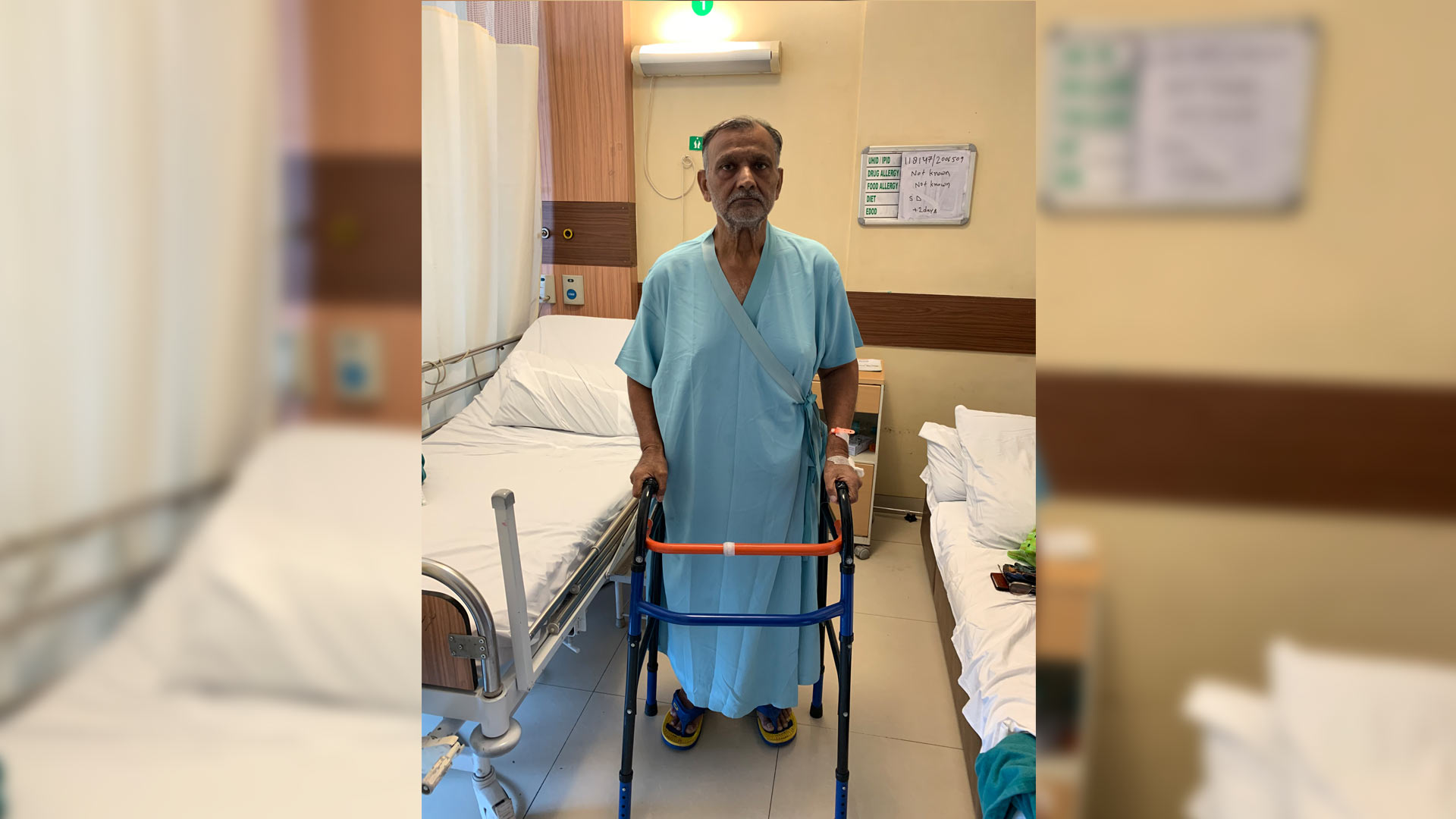 ‘Hereditary multiple exostosis’ successfully treated with TKR at Fortis Hospital