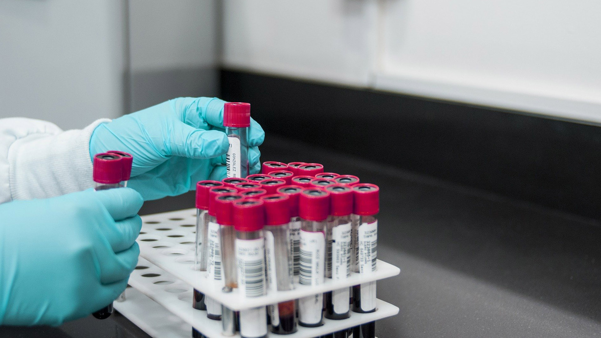 Thermo Fisher’s lupus blood test obtains FDA approval Healthcare Radius