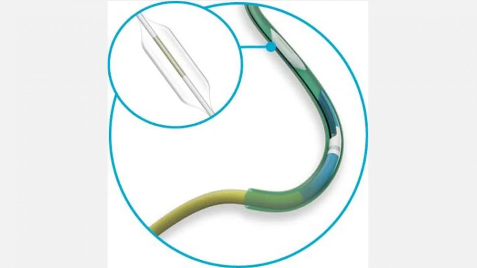 FDA gives clearance for expanded indication for Specialty Catheter and
