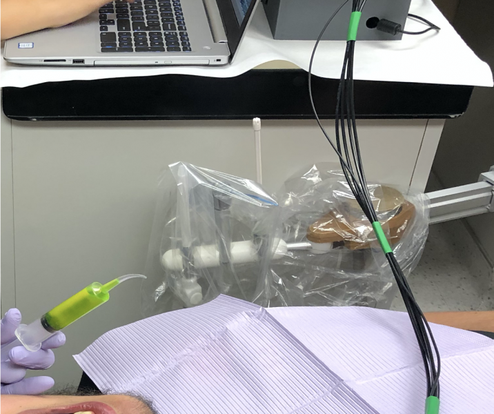 A new dental tool prototype can spot acidic conditions that lead to