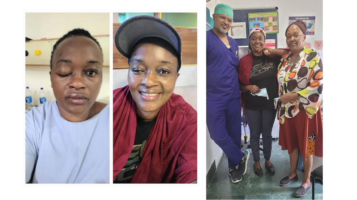 Kenyan patient regains vision after endoscopic surgery at BGS GGH