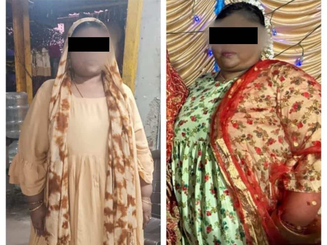 Surgery helps woman beat severe sleep apnea and obesity