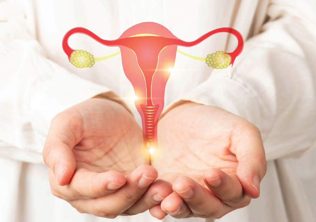 Ovarian Cancer