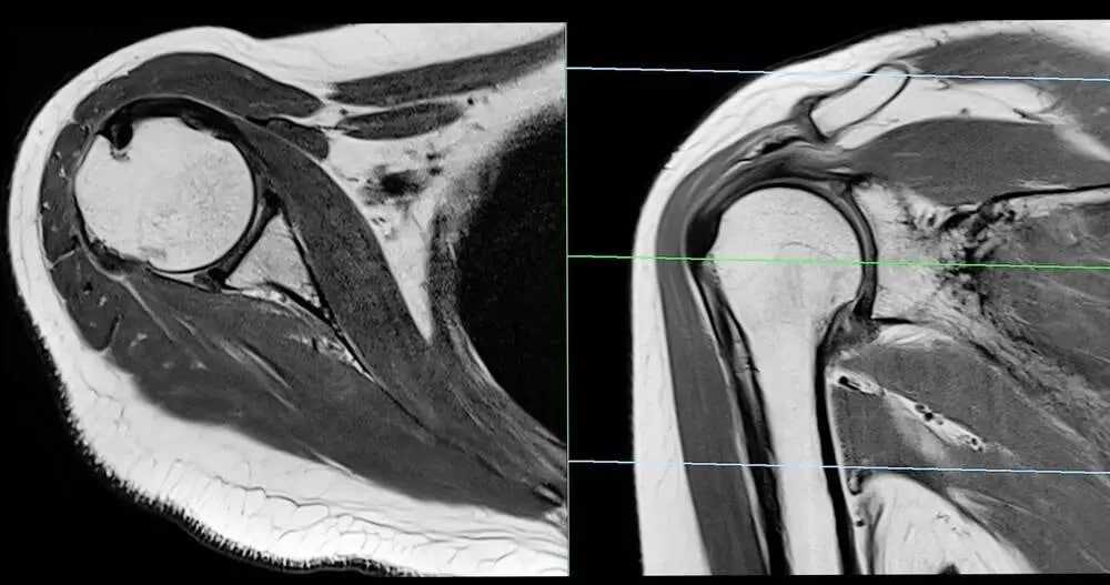 How latest MRI techniques are helping doctors spot soft tissue injuries faster - Healthcare Radius