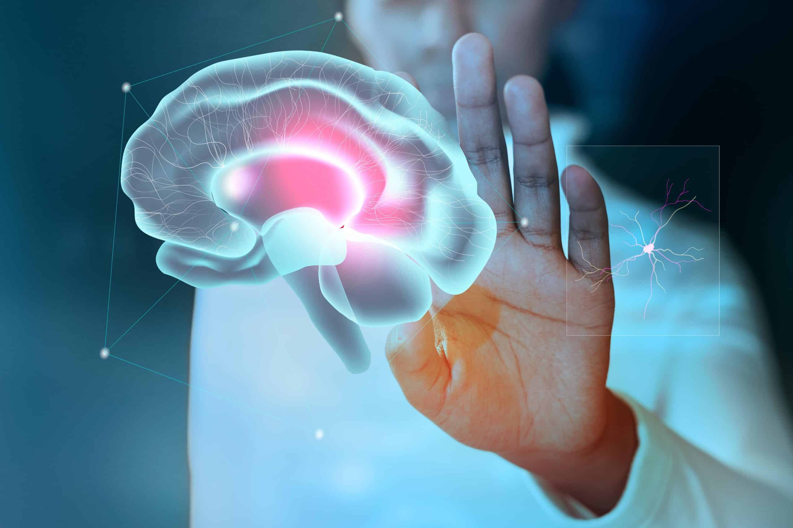 Parkinson's disease