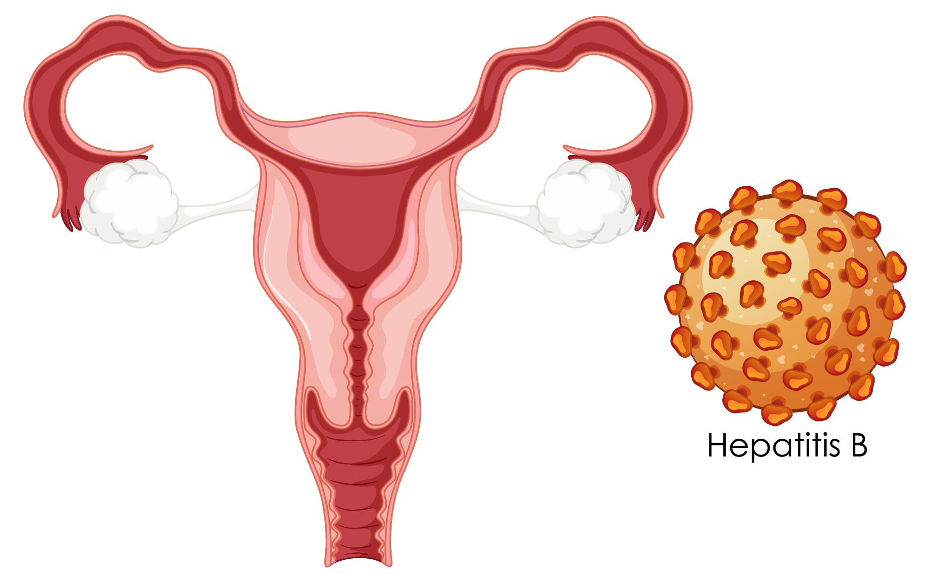 Cervical Cancer