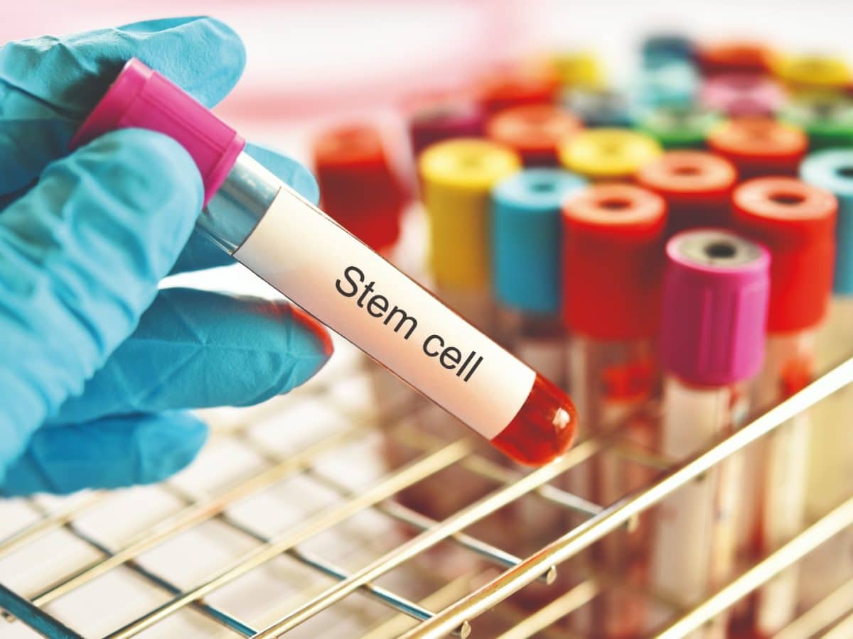 Stem cell