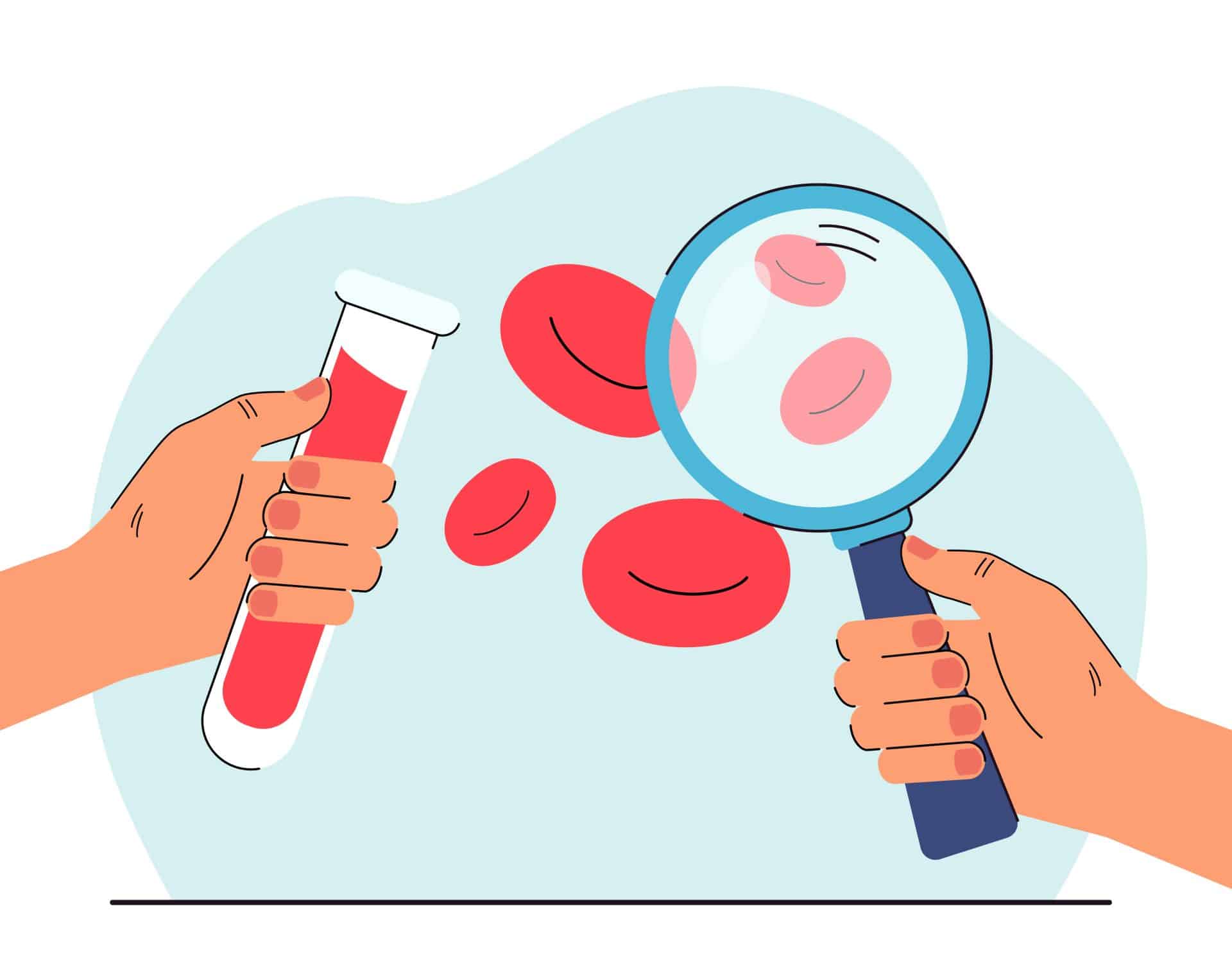 Anemia