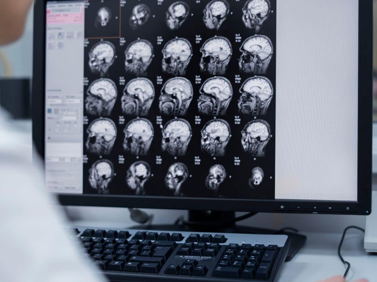 Brain Tumor