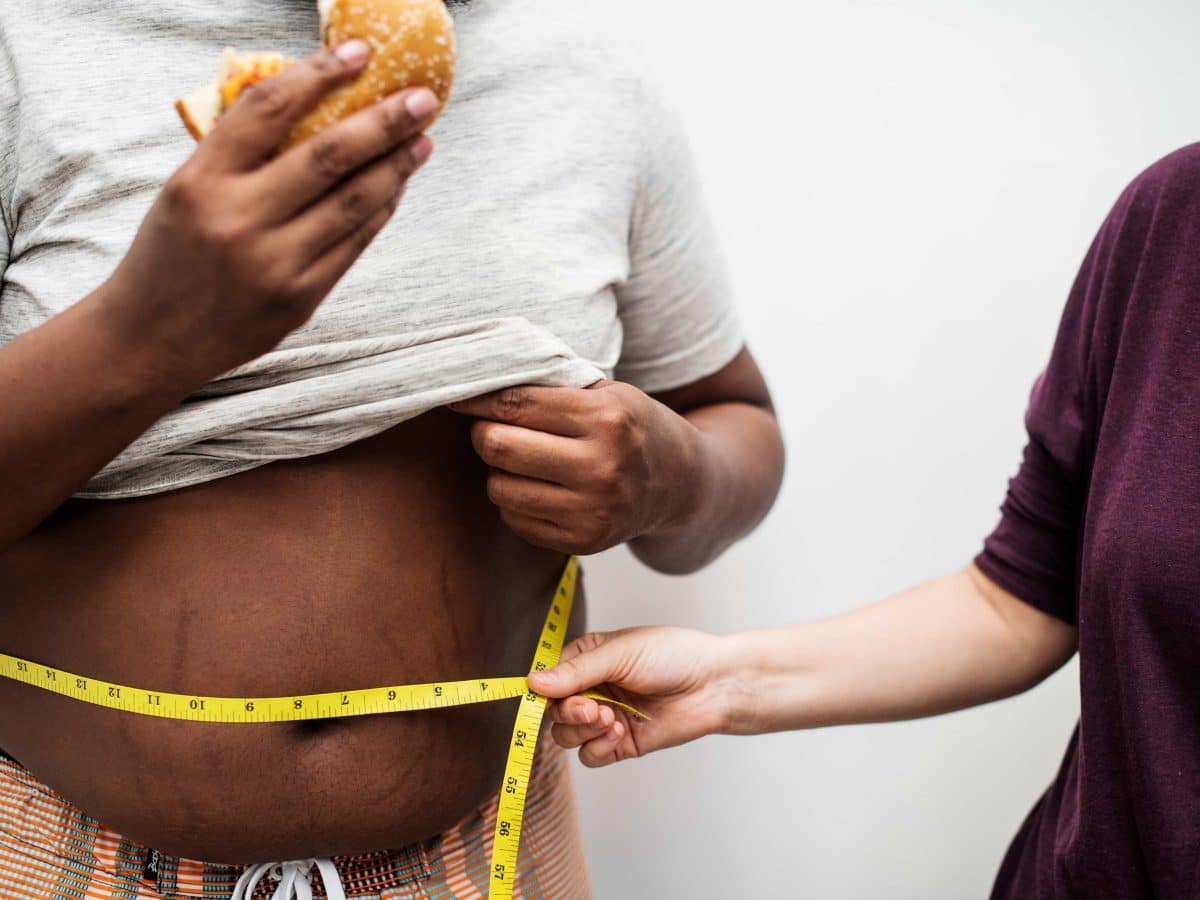 Obesity