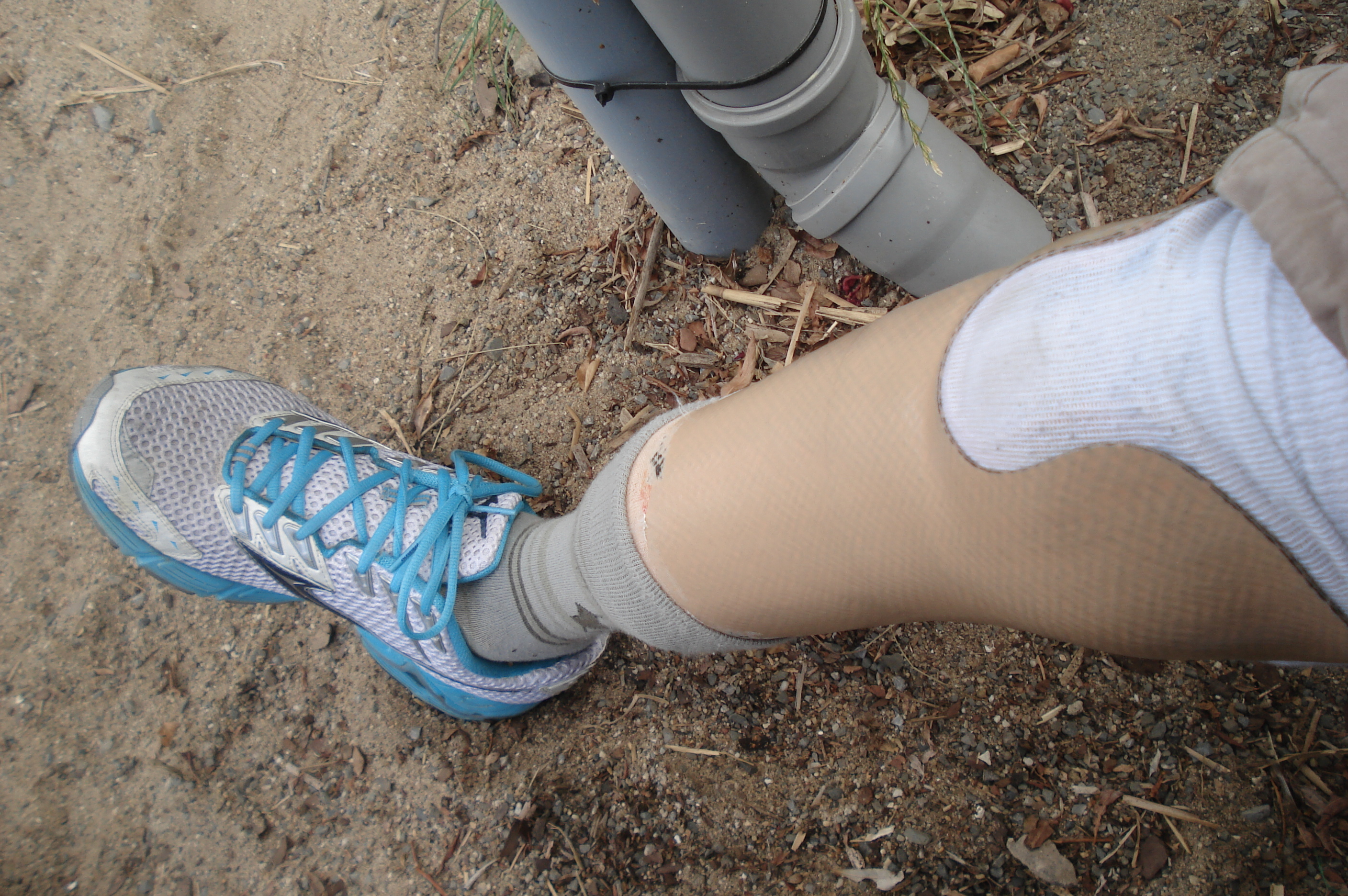 Free Jaipur foot camps to be held in July & Aug Events Health Care