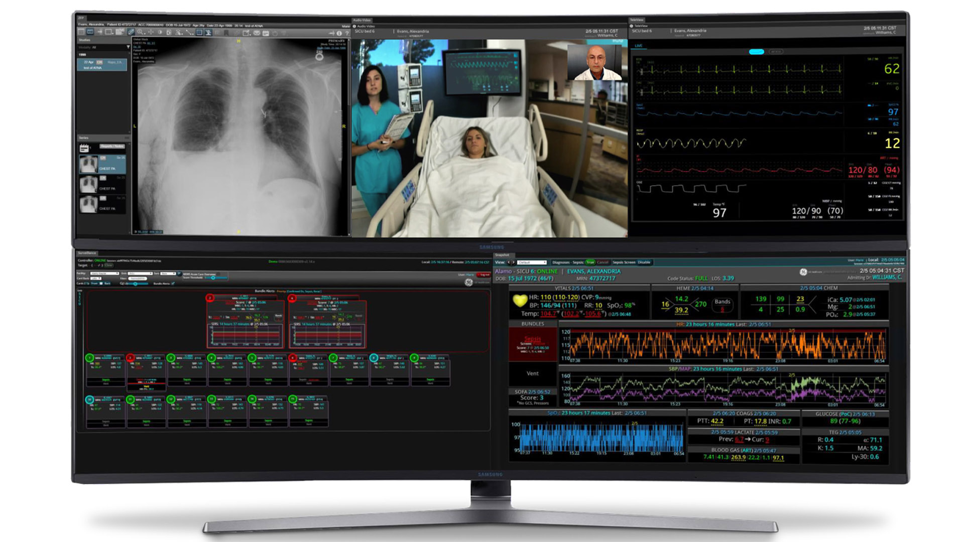 Wipro GE Healthcare introduces remote monitoring solution for the care of COVID19 patients in